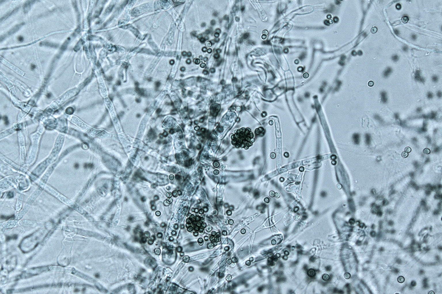 Микропрепарат гриба. Триходерма viride. Trichoderma harzianum мицелий. Микроскопия Trichoderma. Trichoderma viride в микроскопе.